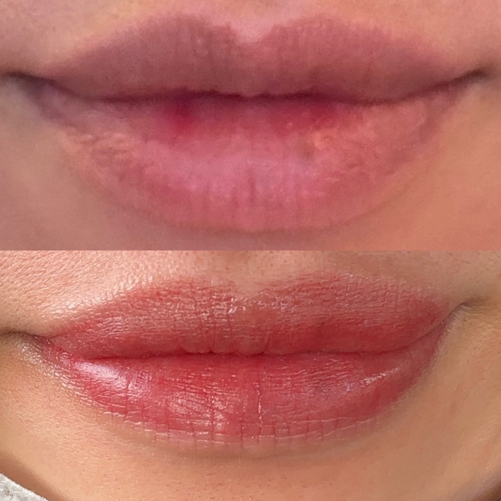 rinnnnさんのレビュー画像