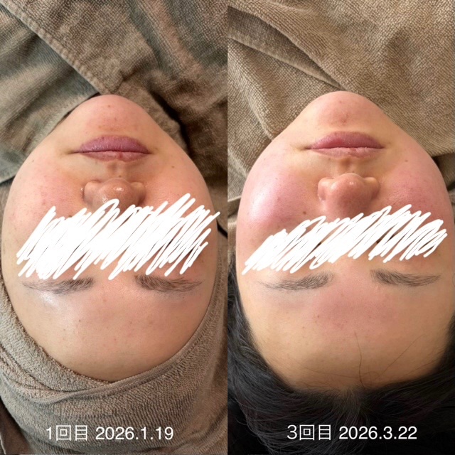 まさんのレビュー画像